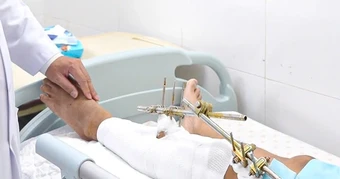 4 giờ căng thẳng giành lại đôi chân cho chàng trai bị tai nạn giao thông