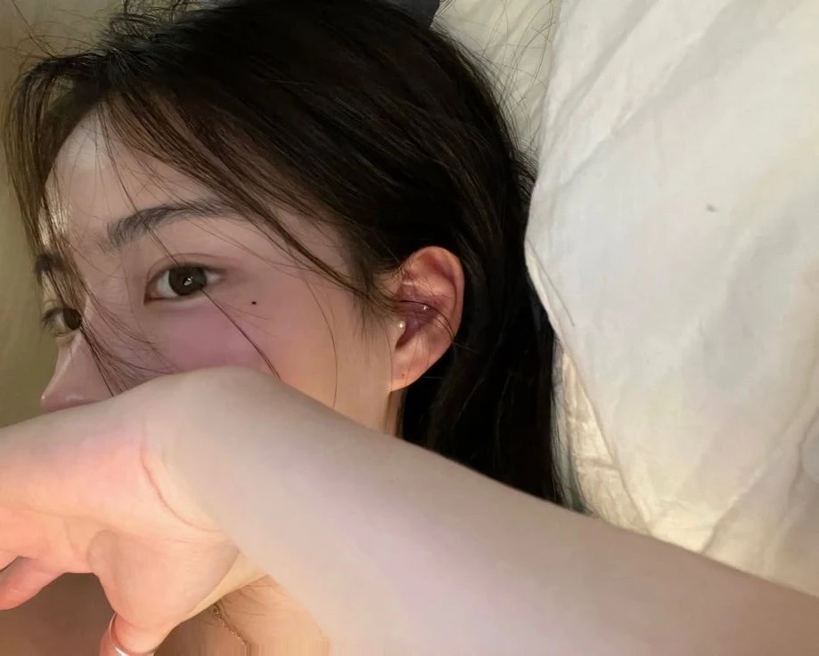 4 kiểu ngứa báo hiệu tế bào ung thư đang "lớn nhanh như thổi" 4 kiểu ngứa báo hiệu tế bào ung thư đang "lớn nhanh như thổi"