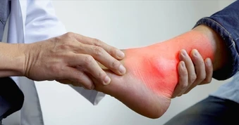 4 sai lầm thường gặp khi điều trị bệnh gút