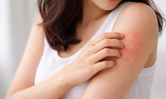 5 thay đổi trên cơ thể cảnh báo thận hoạt động kém