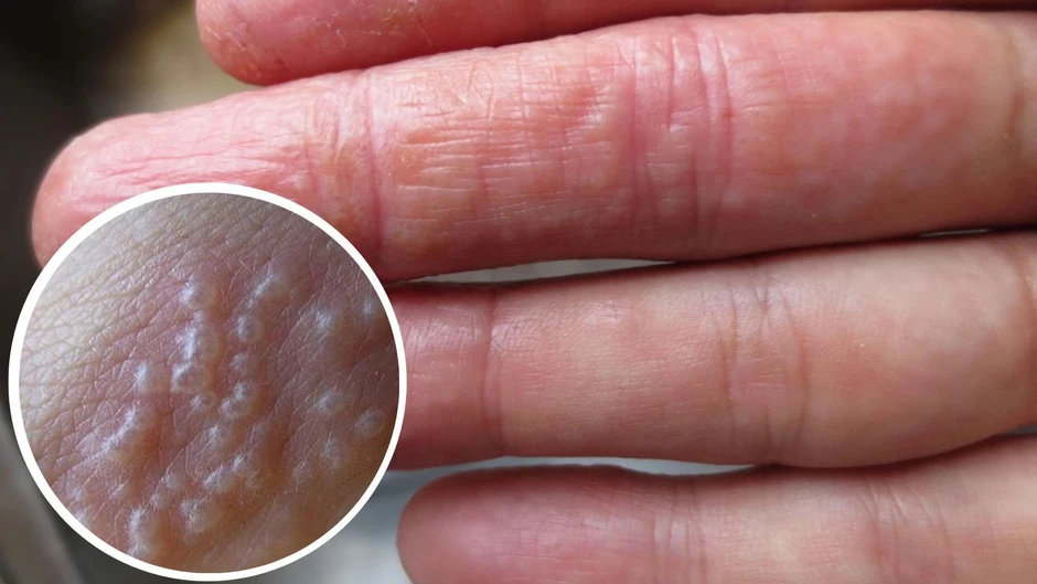 6 bất thường ở ngón tay cảnh báo nhiều bệnh nặng, đặc biệt là ung thư! 6 bất thường ở ngón tay cảnh báo nhiều bệnh nặng, đặc biệt là ung thư!