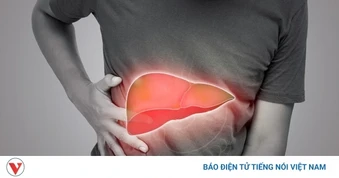 6 dấu hiệu cảnh báo gan nhiễm mỡ, nhiều người hay gặp nhưng lại ngó lơ