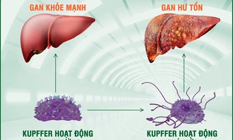 6 nguyên nhân gây tăng men gan thường gặp - Báo TinVina