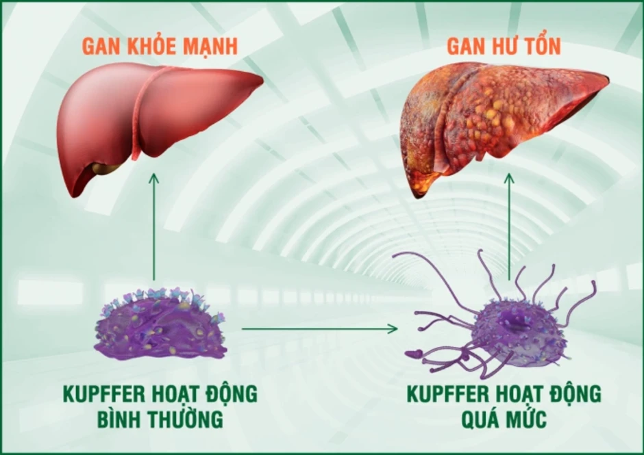 6 nguyên nhân gây tăng men gan thường gặp - Báo TinVina