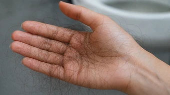 9 dấu hiệu stress trên cơ thể dễ bỏ qua