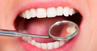 90% người dân Việt gặp vấn đề về răng miệng