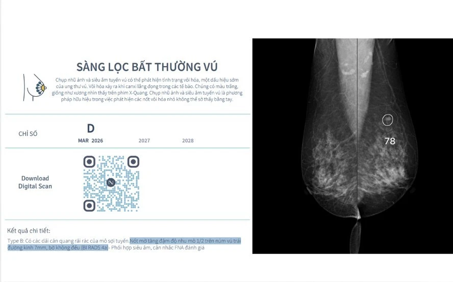 AI đang thay đổi 'ngưỡng phát hiện' trong tầm soát sức khỏe AI đang thay đổi 'ngưỡng phát hiện' trong tầm soát sức khỏe