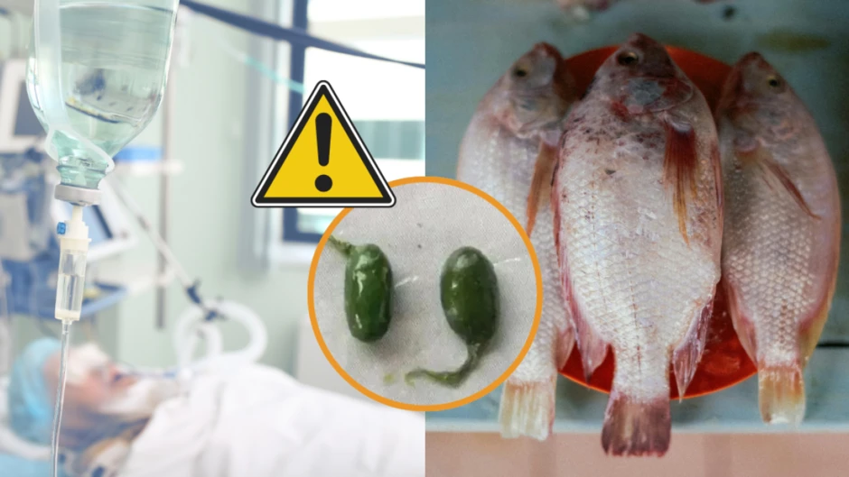 Ăn 1 bộ phận của cá, người phụ nữ suy thận cấp, suy gan: Bác sĩ cảnh báo “nấu chín vẫn nguy hiểm” Ăn 1 bộ phận của cá, người phụ nữ suy thận cấp, suy gan: Bác sĩ cảnh báo “nấu chín vẫn nguy hiểm”