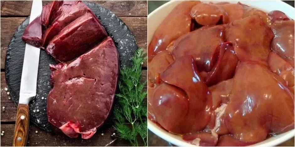 Ăn gan lợn thế nào để không gây hại cho sức khỏe? Ăn gan lợn thế nào để không gây hại cho sức khỏe?