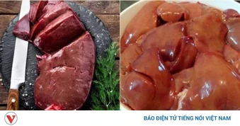 Ăn gan lợn thế nào để không gây hại cho sức khỏe?