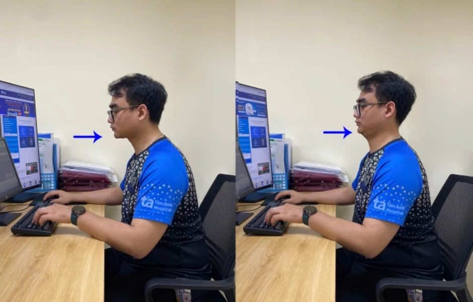 Ba bài tập giảm mỏi cổ vai gáy tại bàn cho dân văn phòng - Báo TinVina Ba bài tập giảm mỏi cổ vai gáy tại bàn cho dân văn phòng - Báo TinVina