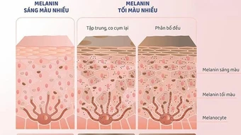 Ba lầm tưởng về sắc tố da melanin - Báo TinVina
