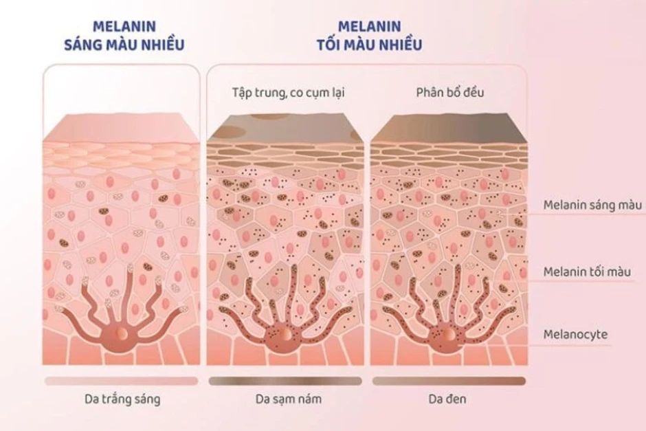 Ba lầm tưởng về sắc tố da melanin - Báo TinVina Ba lầm tưởng về sắc tố da melanin - Báo TinVina