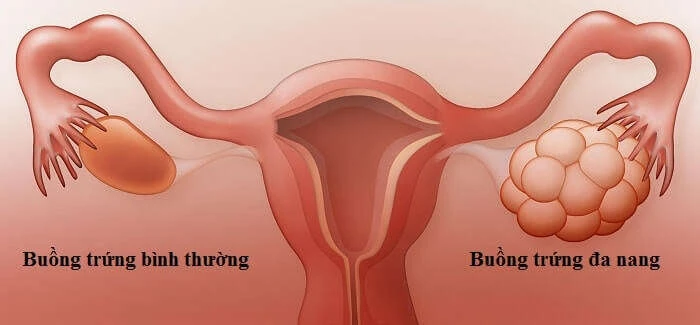 Bác sĩ Bệnh viện Nội tiết Trung ương: Dấu hiệu nhận biết sớm các bệnh nội tiết nguy hiểm Bác sĩ Bệnh viện Nội tiết Trung ương: Dấu hiệu nhận biết sớm các bệnh nội tiết nguy hiểm