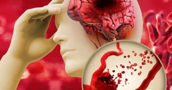 Bác sĩ chỉ rõ “3 chữ” là chìa khóa để không bị đột quỵ, nhồi máu cơ tim