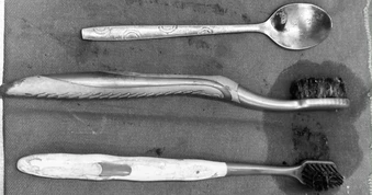 Bác sĩ lấy 2 bàn chải, một thìa inox ra khỏi dạ dày người bệnh