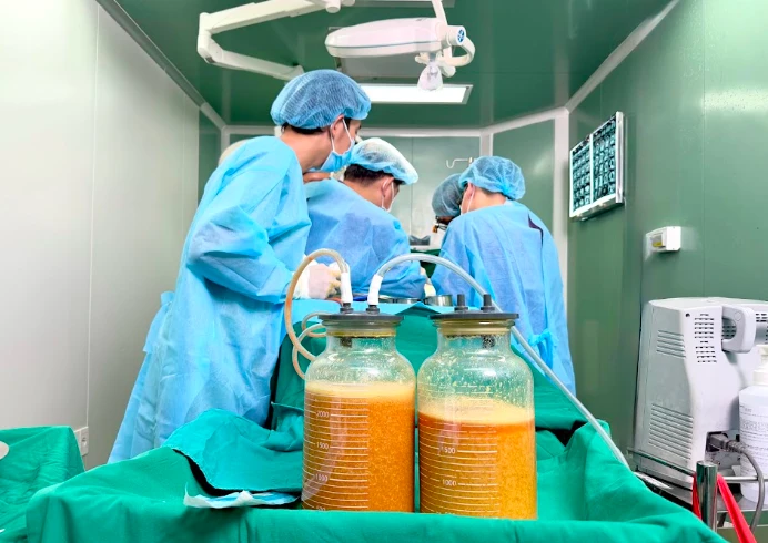 Bác sĩ lấy ra gần 5 lít dịch và 'chất lạ' trong ngực nữ bệnh nhân