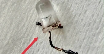 Bác sĩ thót tim gắp đèn LED nằm trong phế quản bé 9 tháng tuổi