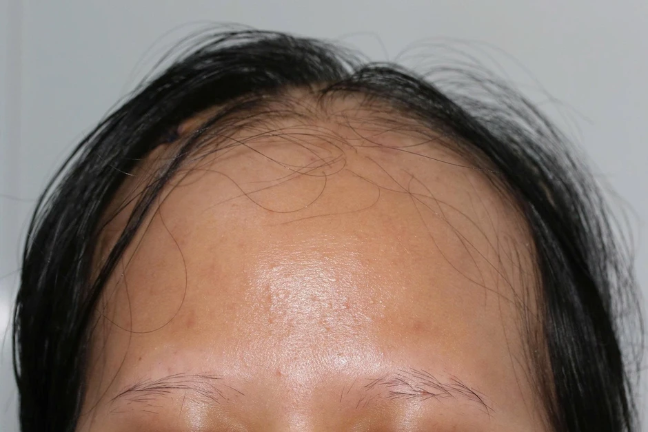Bác sĩ Việt kể quá trình phát hiện ca bệnh chưa từng có trên y văn thế giới Bác sĩ Việt kể quá trình phát hiện ca bệnh chưa từng có trên y văn thế giới