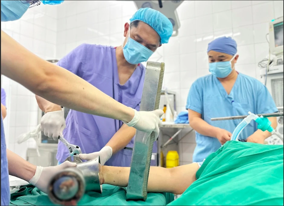 Bàn tay mắc kẹt trong máy xay thịt, người phụ nữ trẻ phải cắt cụt chi