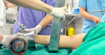 Bàn tay mắc kẹt trong máy xay thịt, người phụ nữ trẻ phải cắt cụt chi