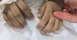 Bé 3 tuổi tím tái, bác sĩ phát hiện ngộ độc nitrit: 6 kiểu đồ ăn thừa cha mẹ nên lưu ý