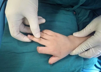 Bé 5 tuổi đứt lìa 2 ngón tay khi chơi xe điện tự chế