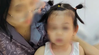 Bé gái 22 tháng tuổi bị tổn thương nghiêm trọng do chó cắn