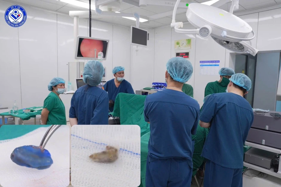 Bé gái 4 tuổi tiết dịch hôi vùng kín suốt 1 tháng, bác sĩ phát hiện 2 dị vật ở sâu bên trong Bé gái 4 tuổi tiết dịch hôi vùng kín suốt 1 tháng, bác sĩ phát hiện 2 dị vật ở sâu bên trong