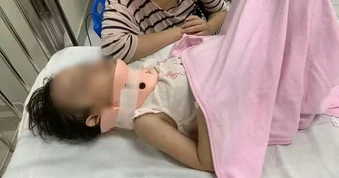 Bé gái bị xô ngã từ cầu trượt khu vui chơi bị vỡ xương trán