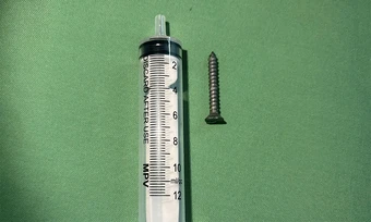 Bé gái nuốt đinh vít dài 2,5 cm