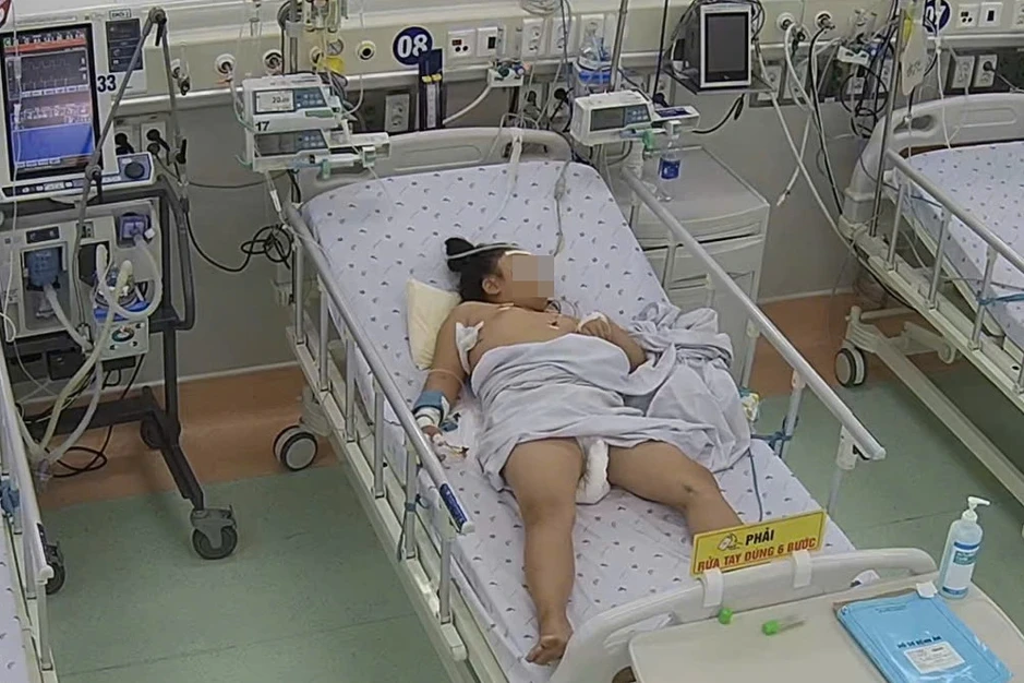 Bé gái suy gan, men gan tăng gấp 100 lần bình thường sau 5 ngày sốt cao