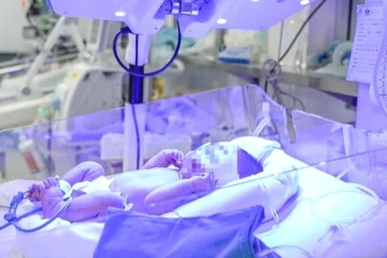 Bé sơ sinh nguy kịch vì nhóm máu cực hiếm, phải truyền máu từ mẹ vừa mổ Bé sơ sinh nguy kịch vì nhóm máu cực hiếm, phải truyền máu từ mẹ vừa mổ