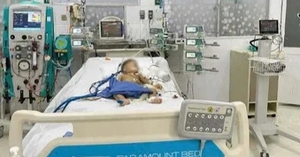Bé trai 14 tháng tuổi bị đàn ong đốt, lọc máu liên tục suốt 44 giờ