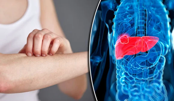 Bé trai 8 tuổi mắc suy thận, urê huyết cao, suy tim nặng: Thói quen ăn uống khiến cha mẹ hối hận