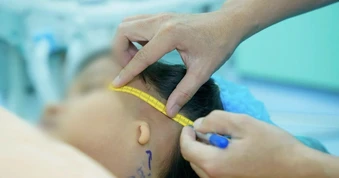Bé trai 8 tuổi phải để tóc dài che kín tai, xuống tinh thần vì bệnh “hiểm”