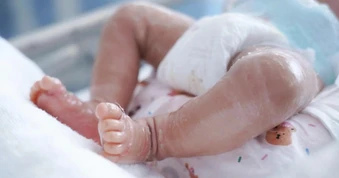 Bé trai ở TPHCM mắc căn bệnh hiếm gặp, vừa sinh ra đã có "vảy cá"