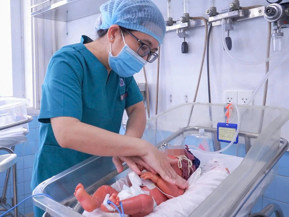 Bé trai sơ sinh da như vảy cá, mi mắt lộn ngược Bé trai sơ sinh da như vảy cá, mi mắt lộn ngược