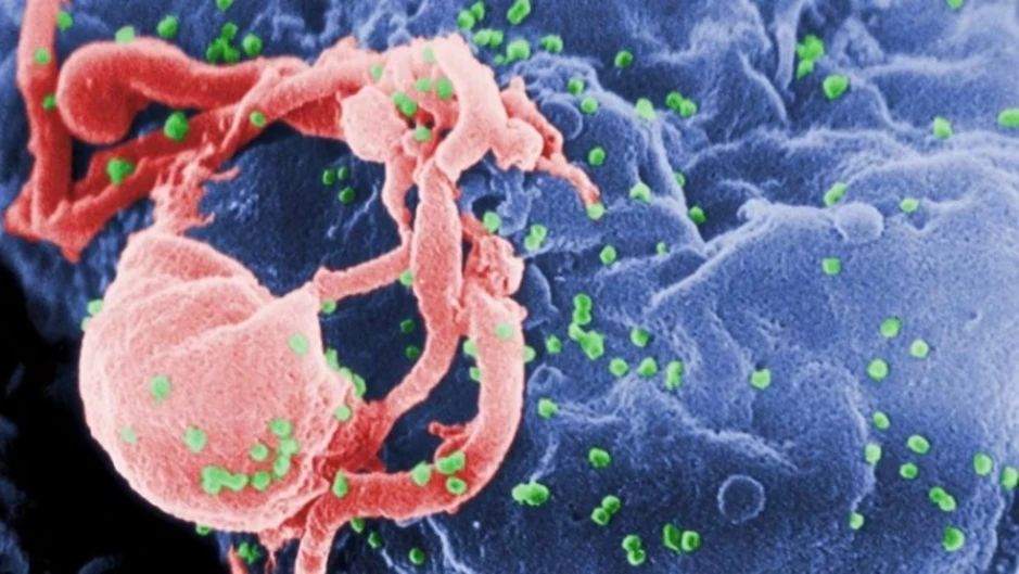 Bệnh nhân Na Uy khỏi cả HIV lẫn ung thư nhờ gene hiếm của anh trai Bệnh nhân Na Uy khỏi cả HIV lẫn ung thư nhờ gene hiếm của anh trai
