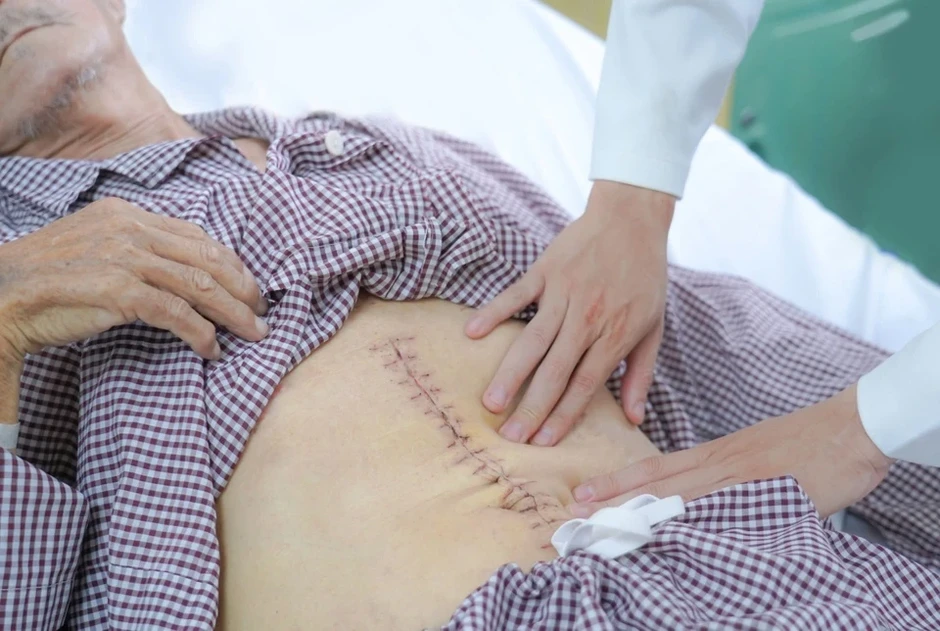 Bệnh nhân ở TP.HCM được cứu nhờ phát hiện 'bom hẹn giờ' trong bụng Bệnh nhân ở TP.HCM được cứu nhờ phát hiện 'bom hẹn giờ' trong bụng