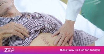 Bệnh nhân ở TP.HCM được cứu nhờ phát hiện 'bom hẹn giờ' trong bụng