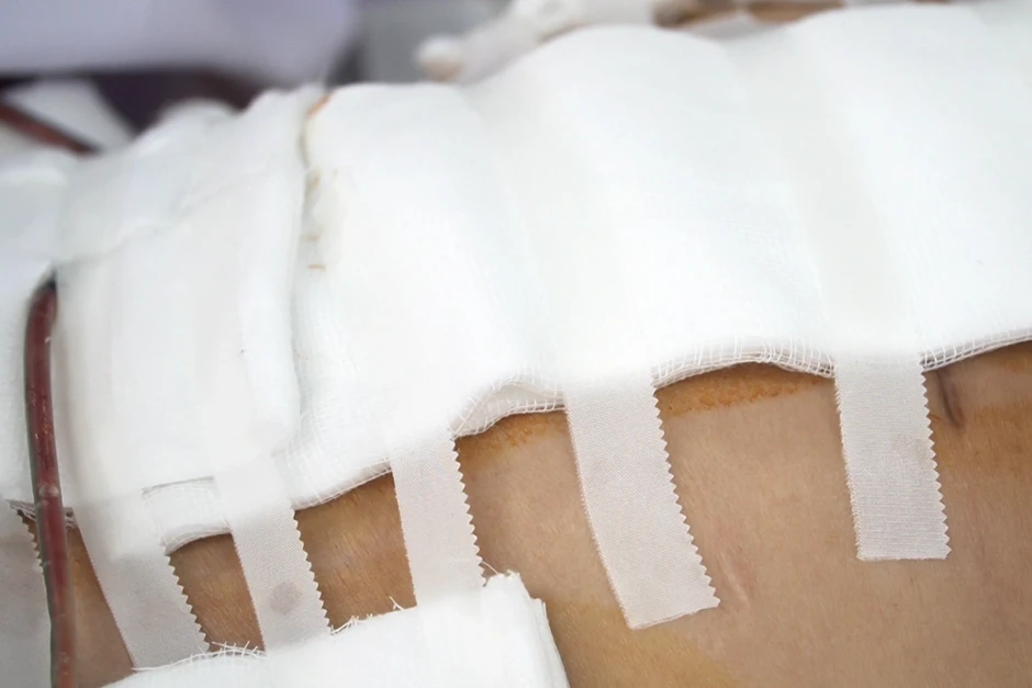 Bệnh nhân quốc tịch Úc tử vong sau khi đặt túi ngực, hút mỡ ở TPHCM Bệnh nhân quốc tịch Úc tử vong sau khi đặt túi ngực, hút mỡ ở TPHCM