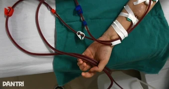 Bệnh suy thận mạn trẻ hóa: Bác sĩ chỉ thói quen nguy hiểm của người trẻ