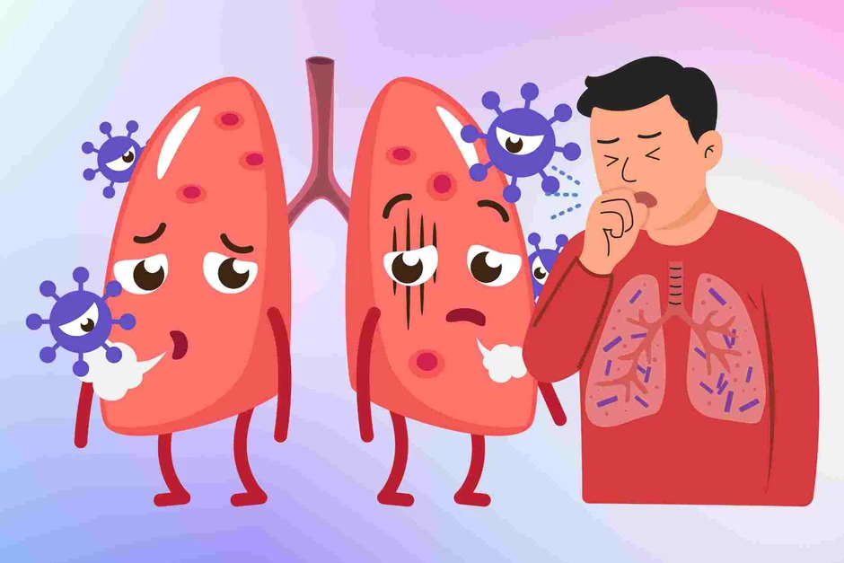 Bệnh viện Bạch Mai cảnh báo 1 căn bệnh dễ nhầm với cúm: Nguy cơ suy hô hấp, sốc tuần hoàn và tử vong sau vài giờ Bệnh viện Bạch Mai cảnh báo 1 căn bệnh dễ nhầm với cúm: Nguy cơ suy hô hấp, sốc tuần hoàn và tử vong sau vài giờ