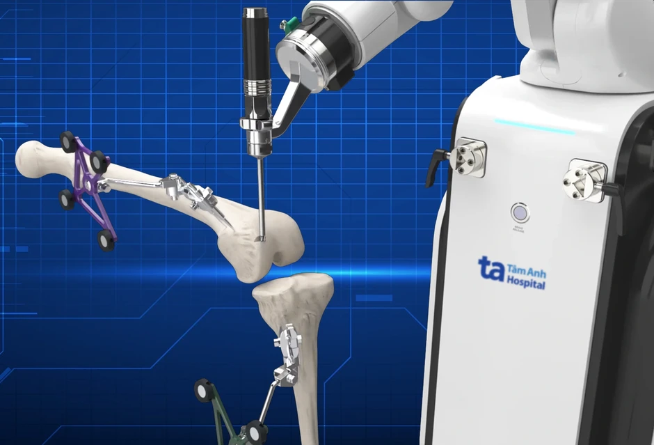 Bệnh viện Tâm Anh đạt 3 chứng nhận quốc tế xuất sắc với Robot AI thay khớp