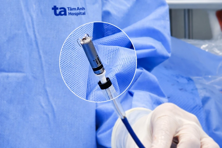 Bệnh viện Tâm Anh tiên phong kỹ thuật tạo nhịp tim không dây thế hệ mới Bệnh viện Tâm Anh tiên phong kỹ thuật tạo nhịp tim không dây thế hệ mới