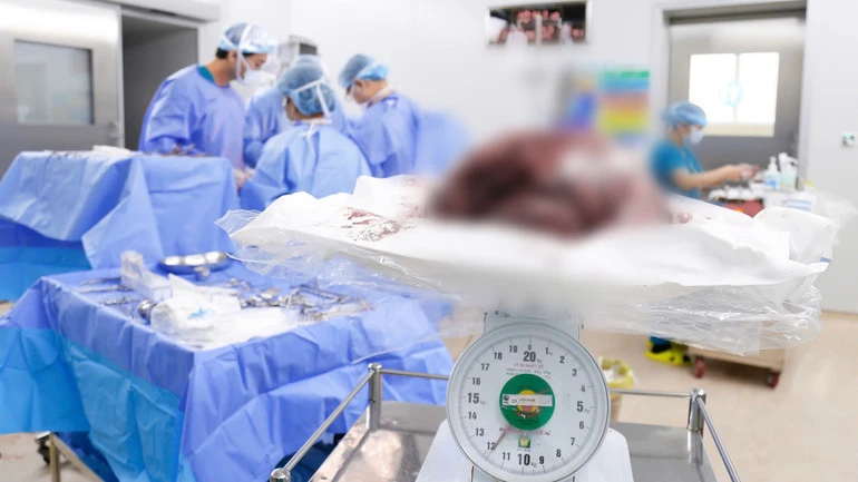 Bệnh viện Từ Dũ phẫu thuật bóc tách khối u xơ tử cung kích thước lớn hiếm gặp