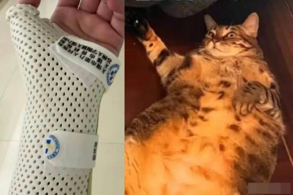 Bị mèo nặng 7,5 kg 'đè' khi ngủ, cô gái gãy xương cổ tay Bị mèo nặng 7,5 kg 'đè' khi ngủ, cô gái gãy xương cổ tay