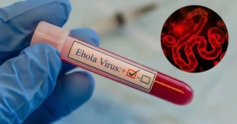 Bộ Y tế cảnh báo 4 dấu hiệu bất thường của dịch Ebola, chủ động ngăn chặn xâm nhập