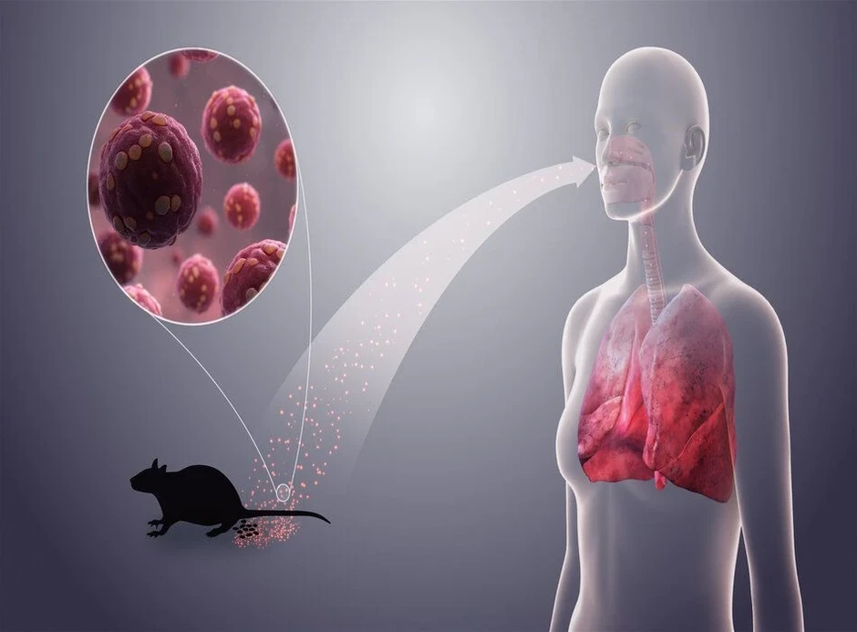 Bộ Y tế cảnh báo khẩn sau vụ 3 người tử vong do virus Hanta trên tàu du lịch Bộ Y tế cảnh báo khẩn sau vụ 3 người tử vong do virus Hanta trên tàu du lịch